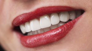 Why Dental Implants Are the Best Tooth Replacement Option