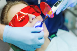 Laser Dentistry Advancements