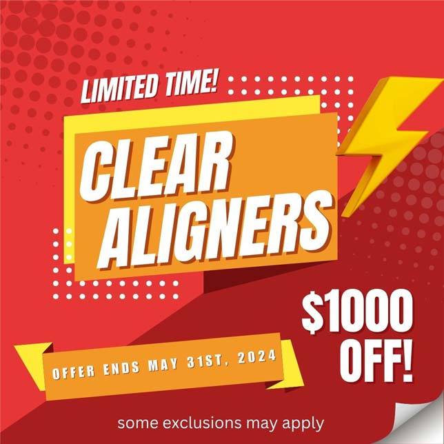 Clear Aligners Special